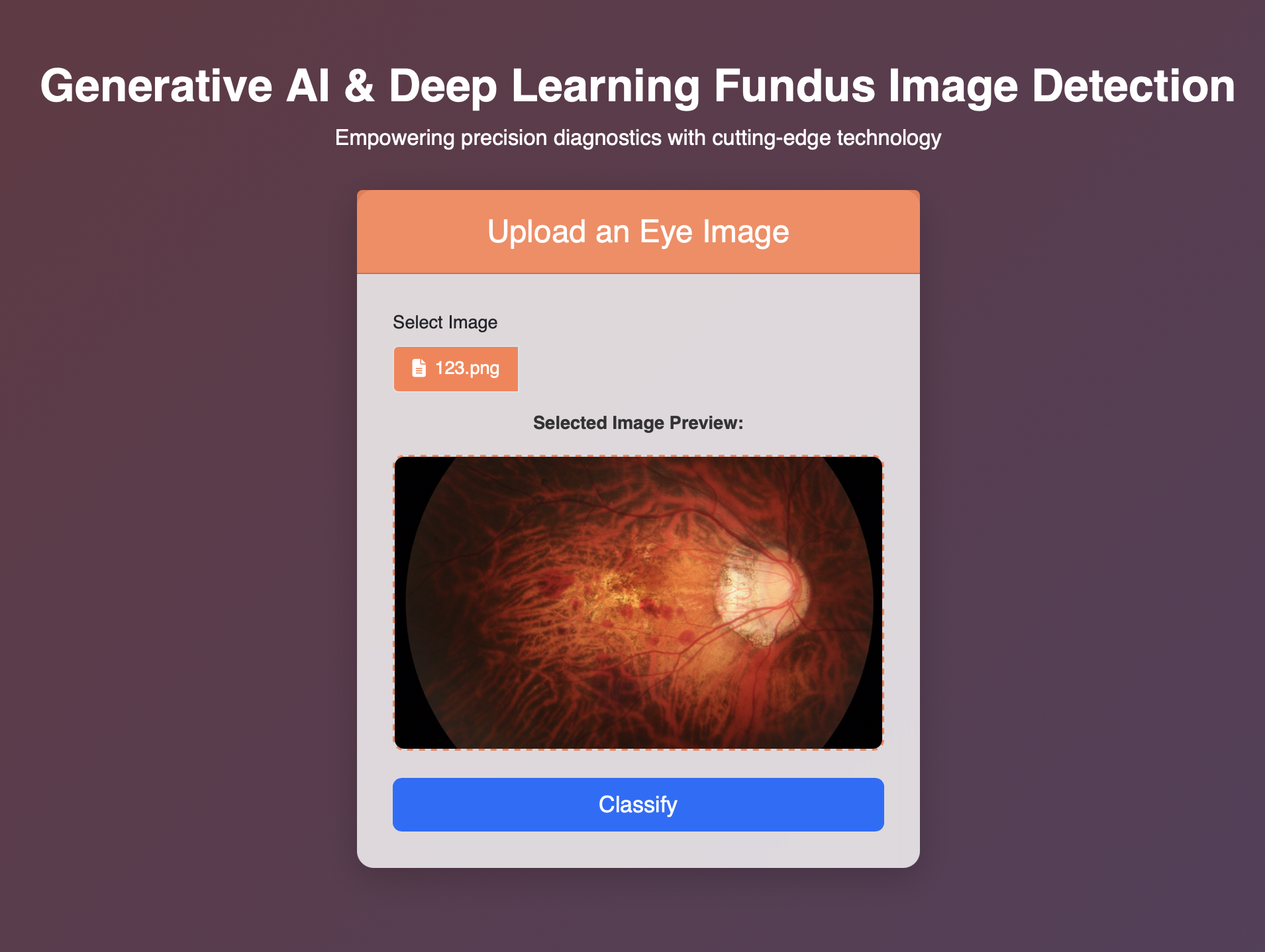 Eye Disease Detection